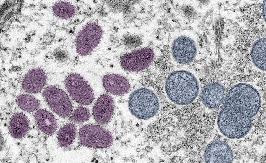 monkeypox virus under microscope.